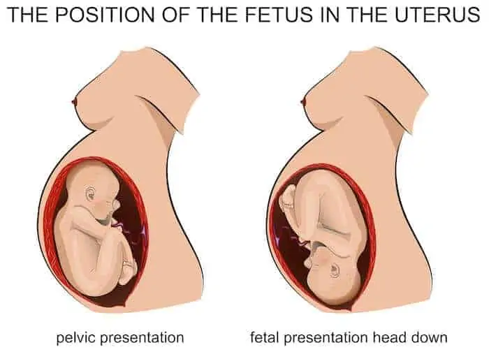 fetus in the uterus