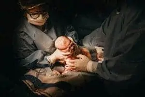 woman giving birth after cesarean surgery