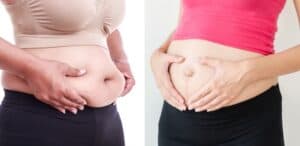 Bloated vs pregnant belly side by side
