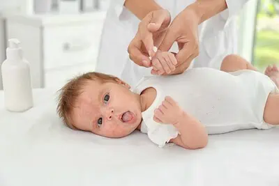 baby skin allergy treatment at hospital