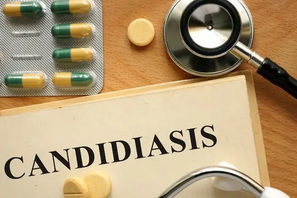 candidiasis